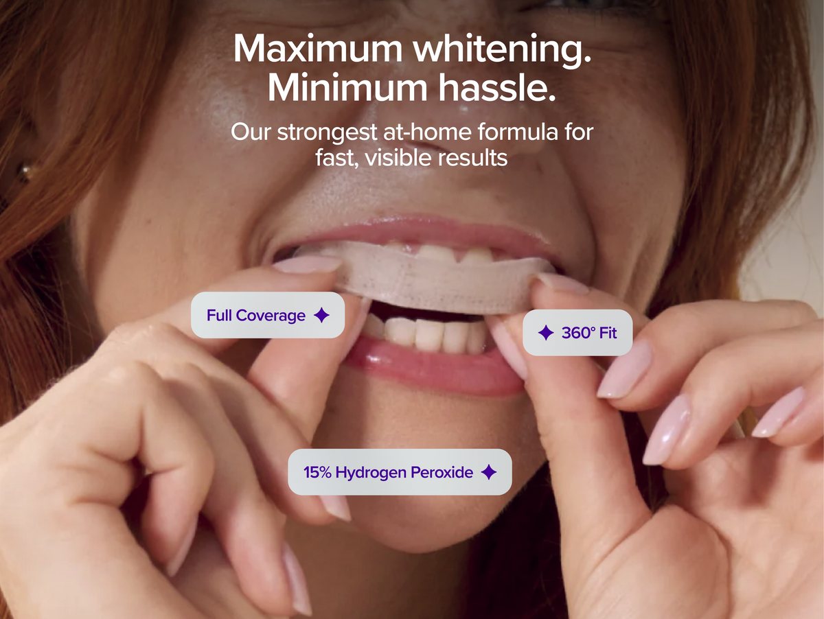 Prefilled Whitening Trays