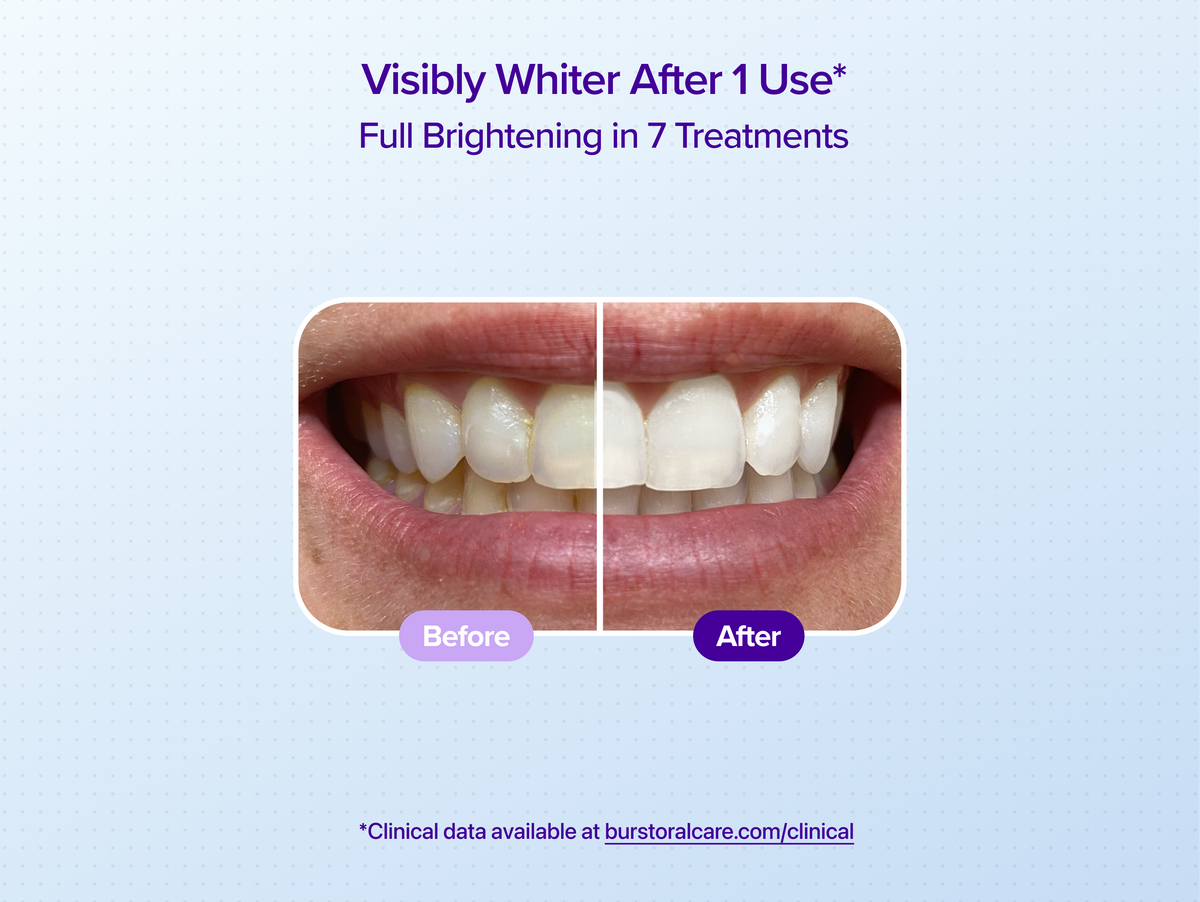 Watermelon Non-Slip Whitening Strips