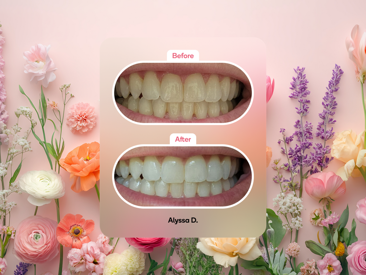 Color: Rose Gold; teeth whitening pen