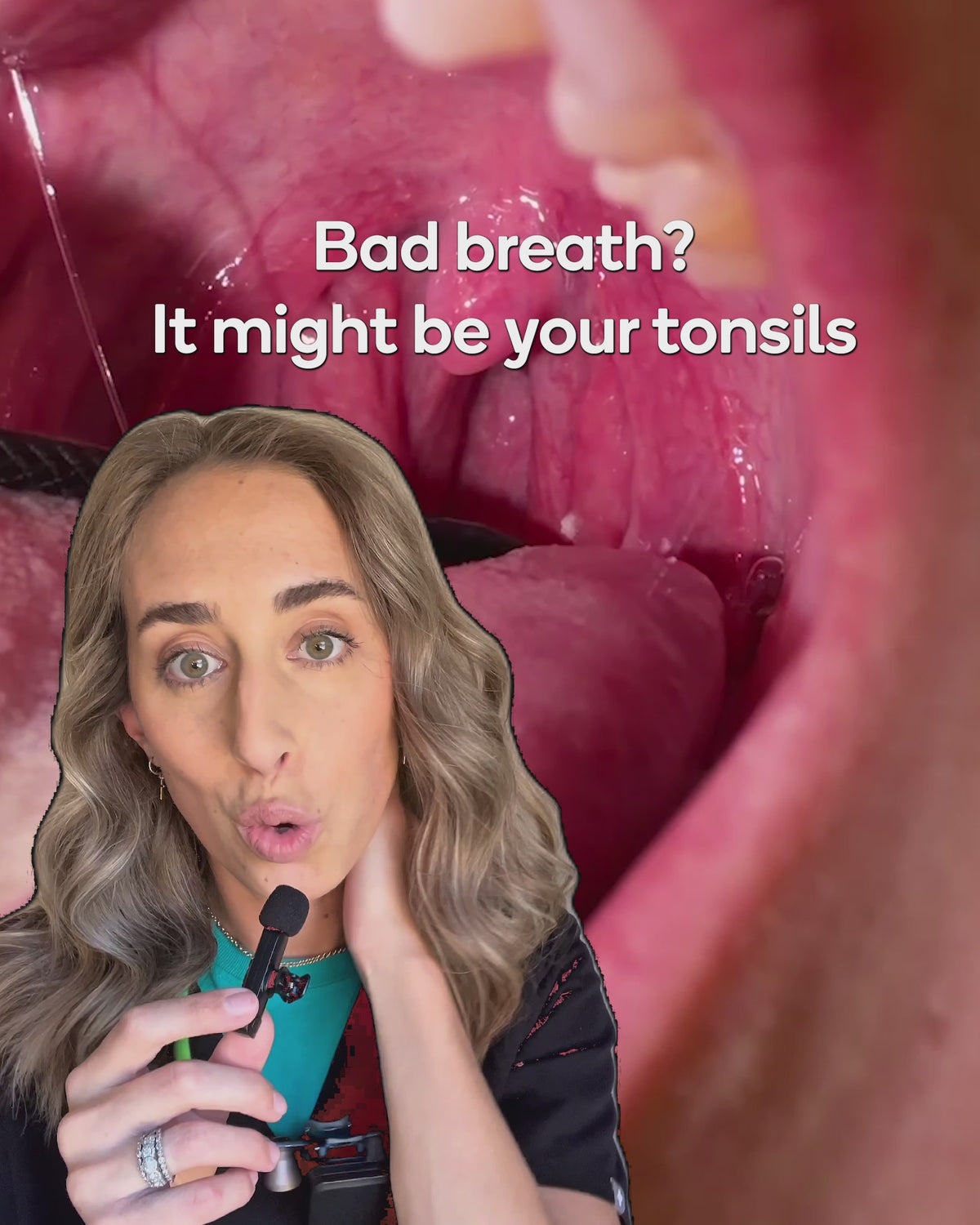 Load video: Oral Probiotics