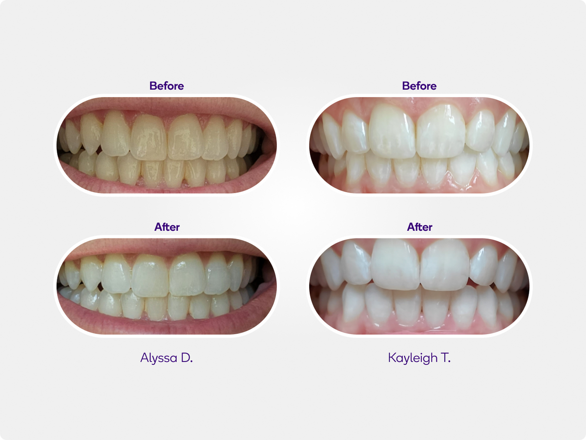 Deal Precision Whitening Pen
